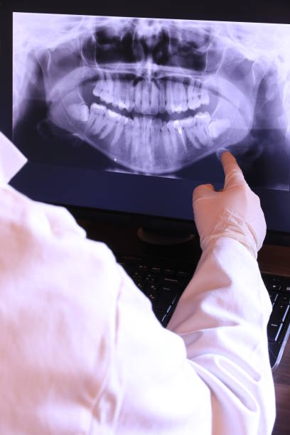Best Dental Abscess Treatment in Marion, MS